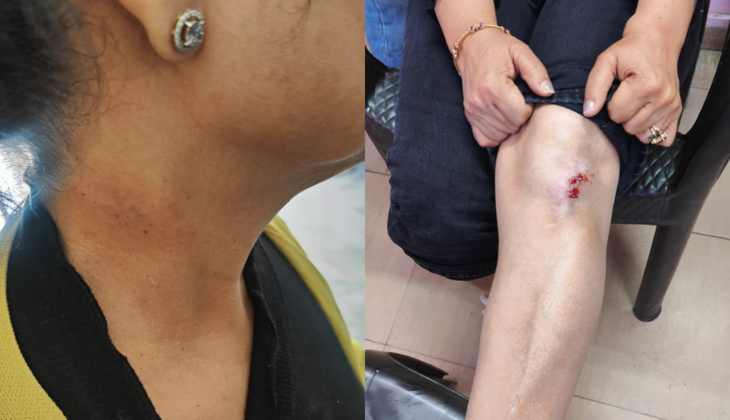 Violent Assault in Noida: Family Attacked Over Minor Car Bump In Sector-18, Police File FIR