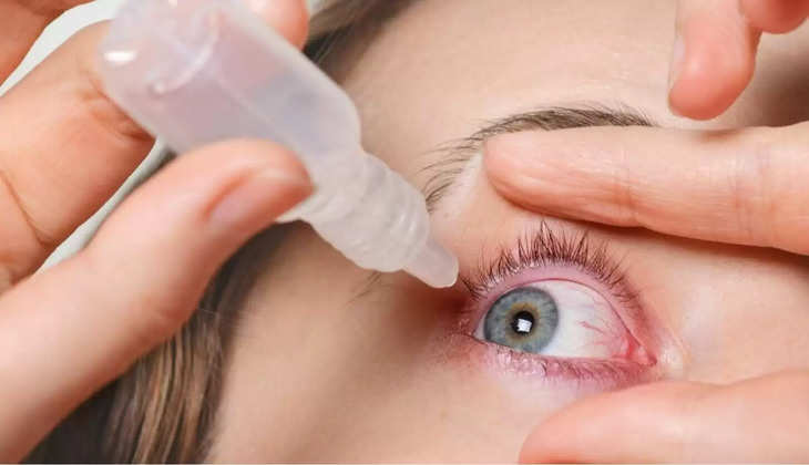 Eye Flu Treatment At Home: आई फ्लू ड्रॉप  ​​भी ज्यादा असरदार हैं ये 5 चीजें, दर्द और जलन से तुरंत मिलेगी राहत